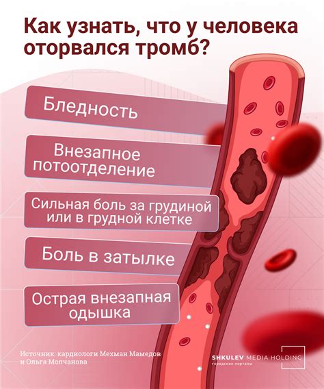 Разрушение тромба: в чем опасность и что можно предпринять