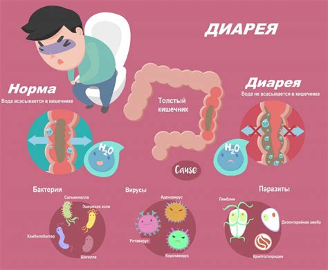 Расстройства желудка и кишечника