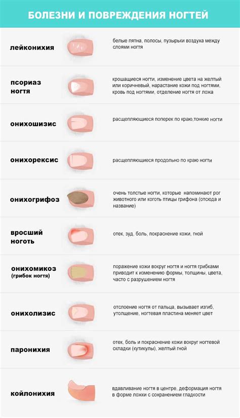 Рекомендации врачей по стрижке ногтей ребенку при болезни