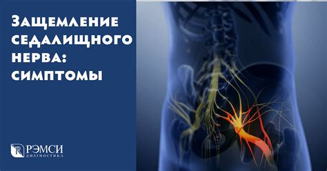 Рекомендации по профилактике защемления нерва