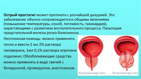 Рекомендации по частоте подмывания мочеполовых органов мылом