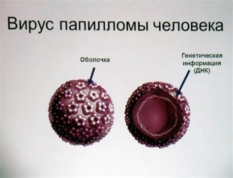 Риски и последствия ВПЧ