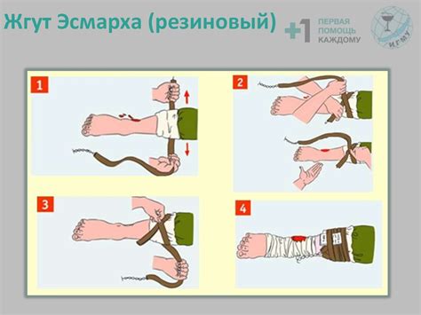 Риски при неправильном использовании жгута