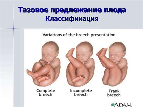 Роды мертвого плода: причины и способы их предотвращения