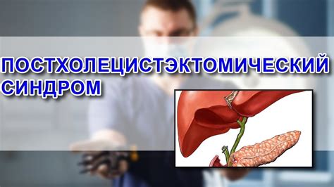 Ряженка после удаления желчного пузыря: что говорят врачи?