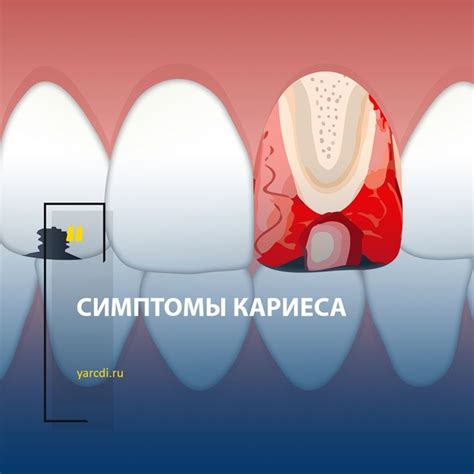 Сборка верхнего слоя одеяла и его фиксация