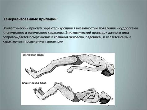 Симптомы, сигнализирующие о возможности возникновения эпилепсии у взрослых