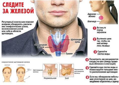 Симптомы давления щитовидной железой на горло