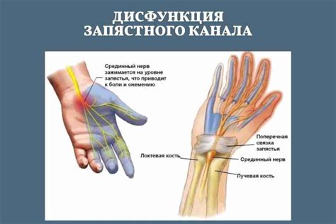 Симптомы защемления нерва: какие проявления сигнализируют о проблеме?