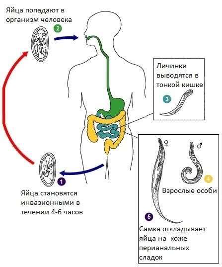 Симптомы и диагностика остриц