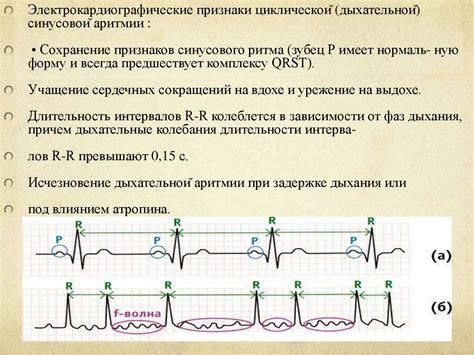 Синусовая аритмия: что это?