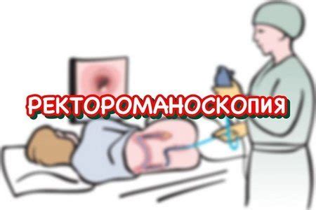 Советы по питью воды перед ректороманоскопией и после