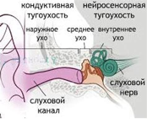 Современные методы восстановления слуха при тугоухости