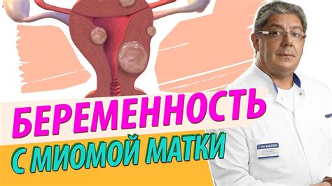 Спираль с миомой: преимущества и риски