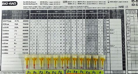 Способы поиска IGG ID