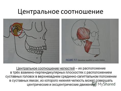 Срединное расположение суставных головок