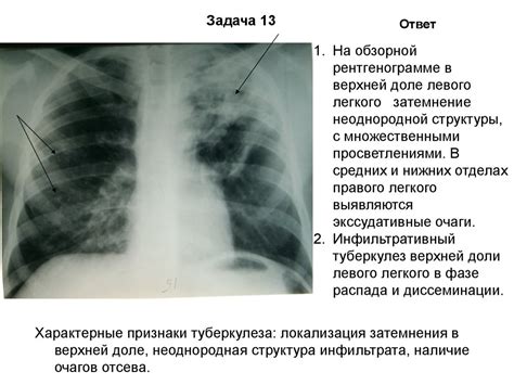 Топ-5 преимуществ КТ легких у детей