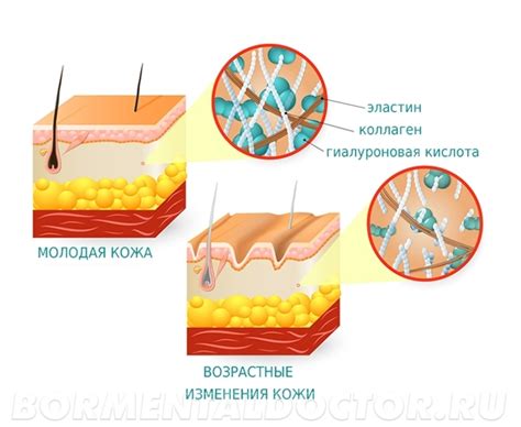 Увеличение тургора кожи