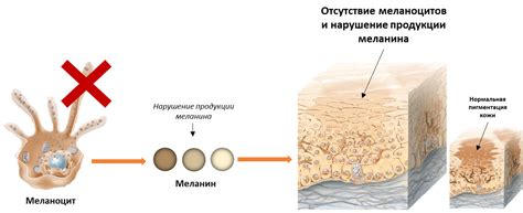 Углеводы и меланин