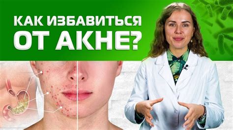 Угревая сыпь: причины и лечение