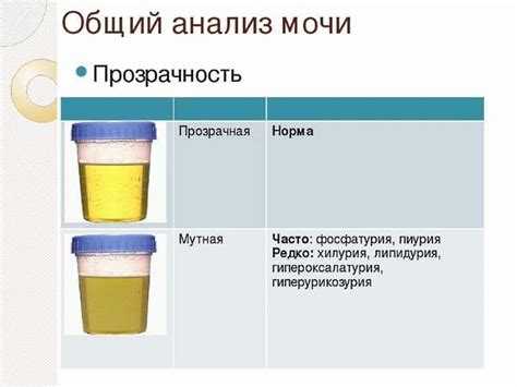 Факты о химическом составе мочи и его влиянии на заживление