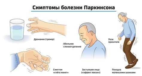 Физическая терапия и реабилитация при паркинсоне на ранней стадии