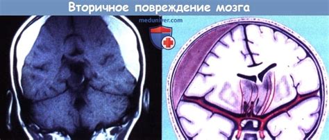 Физическая травма или заболевание головного мозга