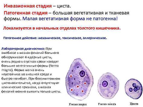 Циста: симптомы и диагностика