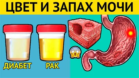 Чем вызван запах мочи у взрослого? Какие причины можно выделить?