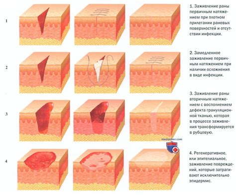 Что нужно знать о степени заживления кожи?