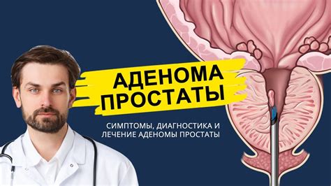 Что такое аденома простаты?