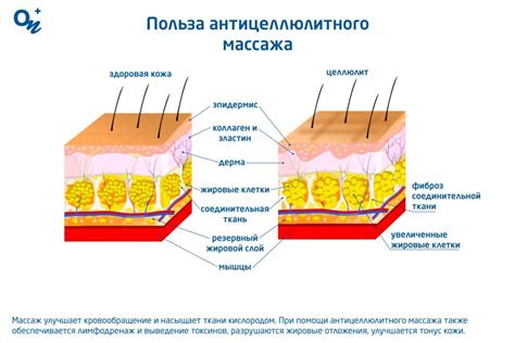 Что такое антицеллюлитный массаж и как он помогает похудеть