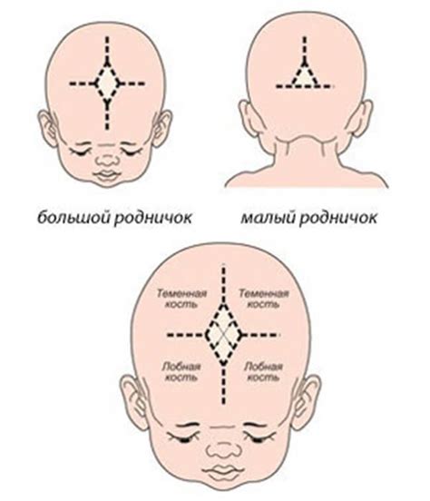 Что такое родничок у младенца?