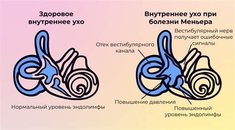 Что такое синдром шуня?