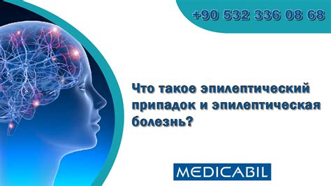 Что такое эпилептическая судорога? Ответ и объяснение