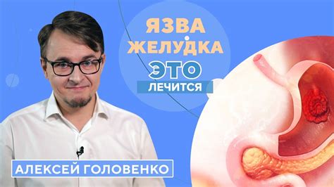 Что такое язва и почему она важна при сдаче крови?