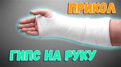 Шаги для нанесения гипса на руку в домашних условиях