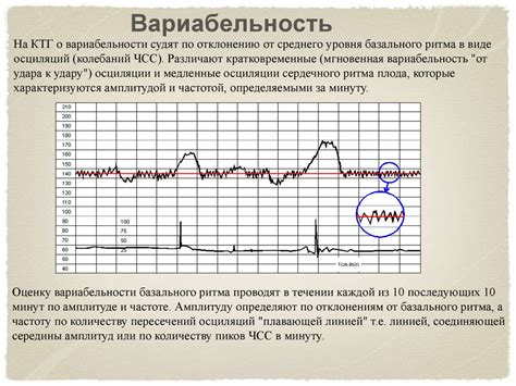  Влияние разговора на КТГ 