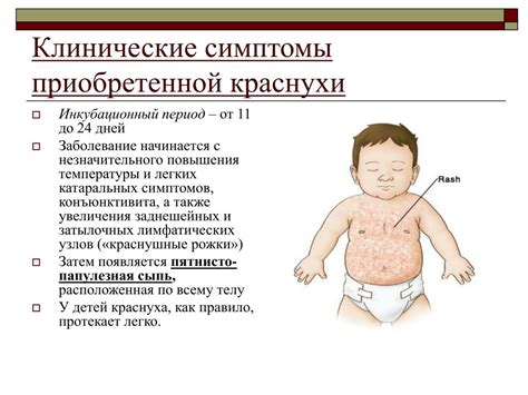  Как передается краснуха? 