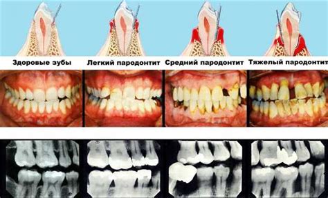  Причины и симптомы воспаленной десны 